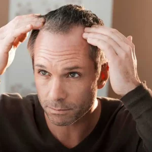 Red Light Therapy for Hair Loss: A Safe and Effective Solution
